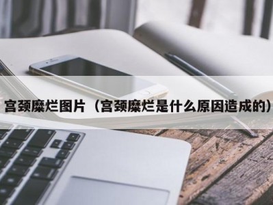 宫颈糜烂图片（宫颈糜烂是什么原因造成的）